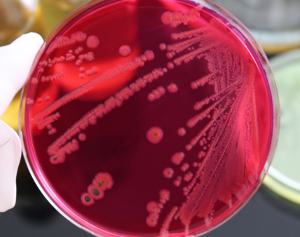 Salmonella w przyprawach, a wycofanie całej partii – nowy wyrok WSA